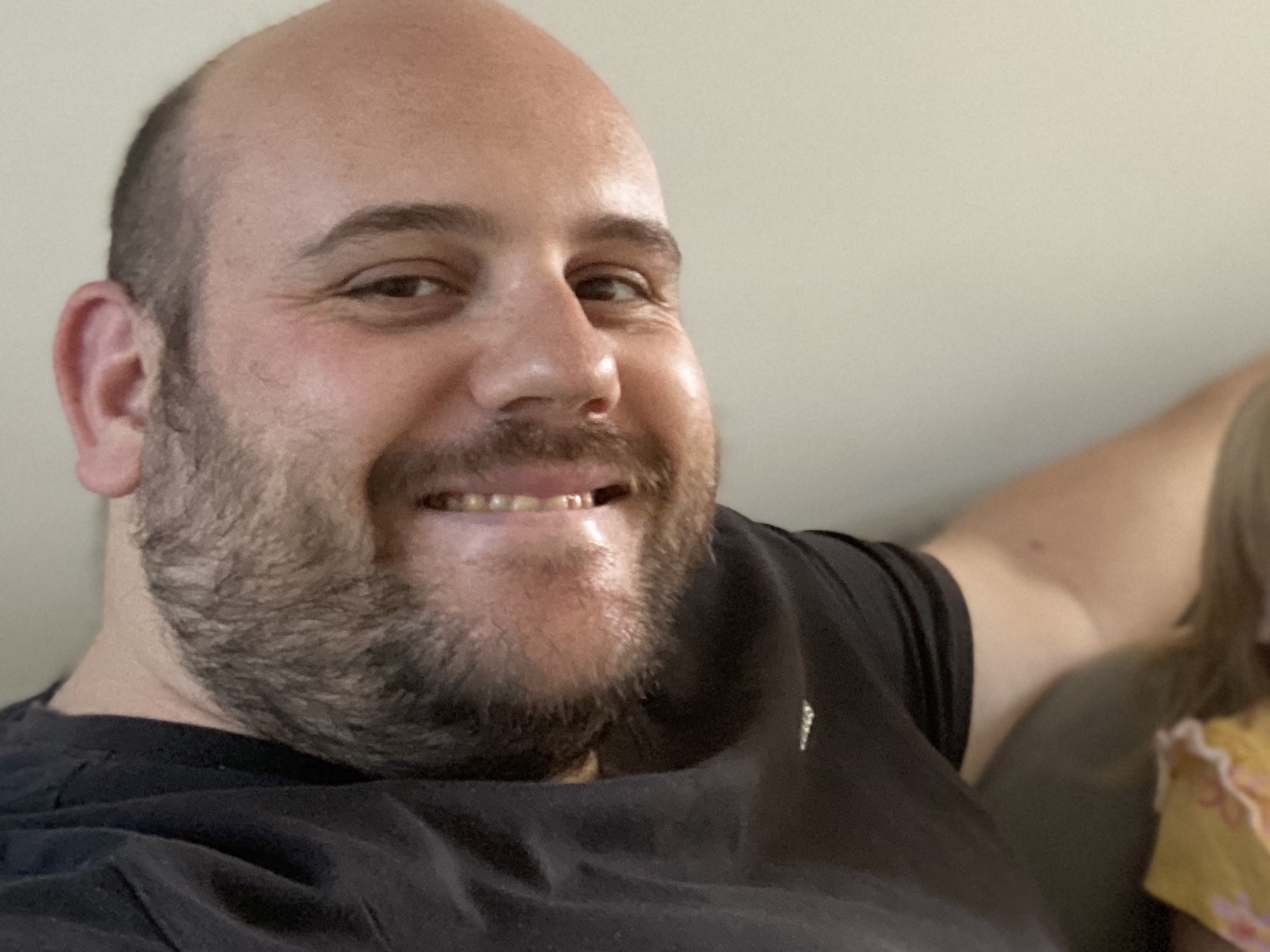 Toby Hoare struggling with obesity and insulin resistance prior to his health journey